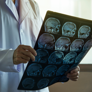 Doctor in a white coat holds a sheet of brain MRI scans for review.